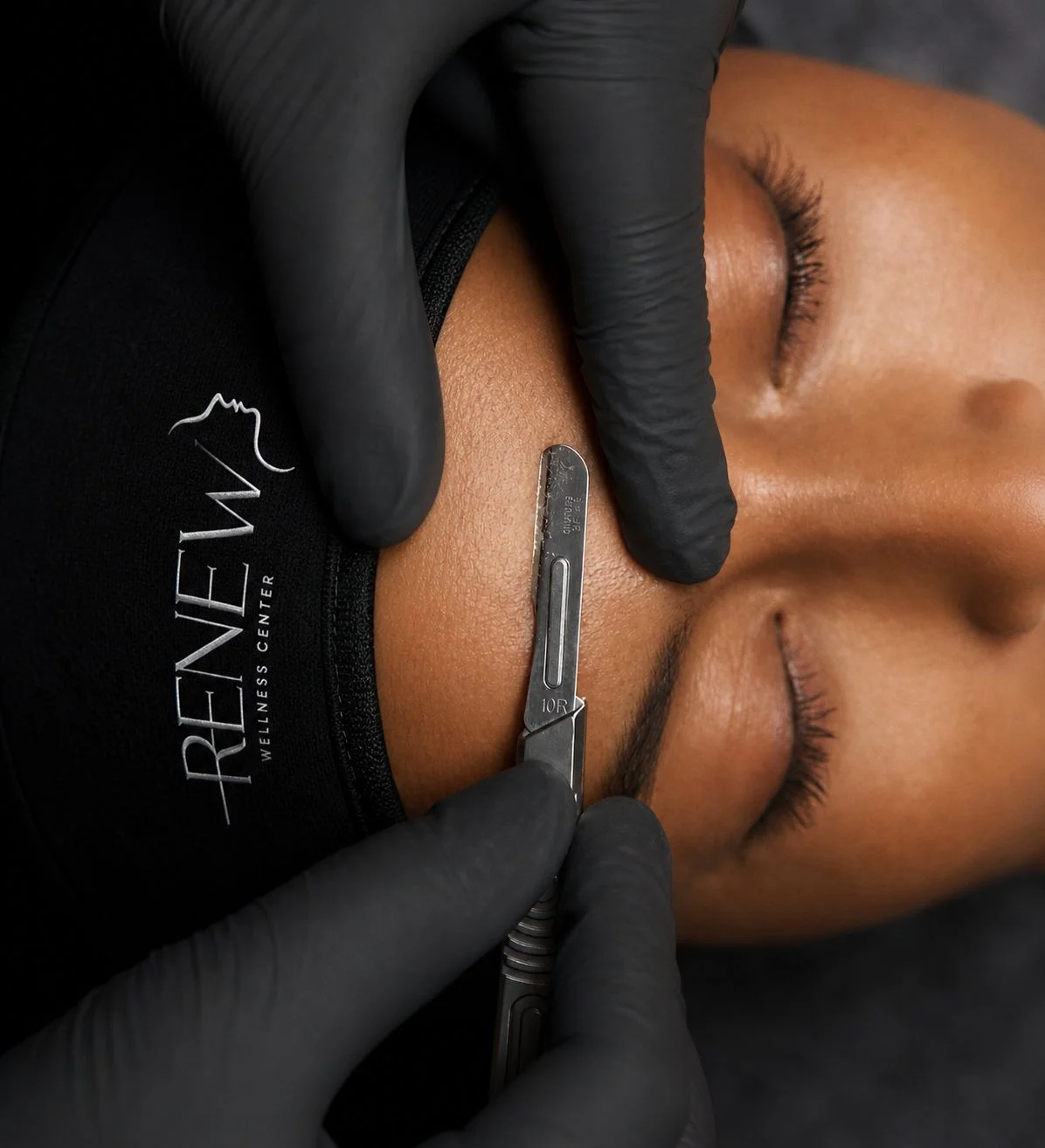 Dermaplaning
